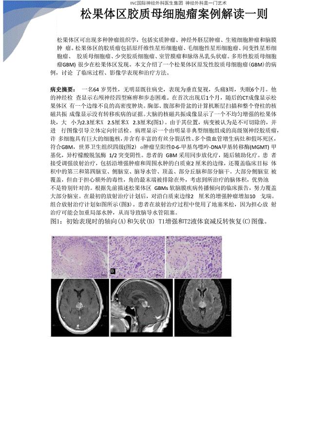 松果体区胶质母细胞瘤案例解读一则