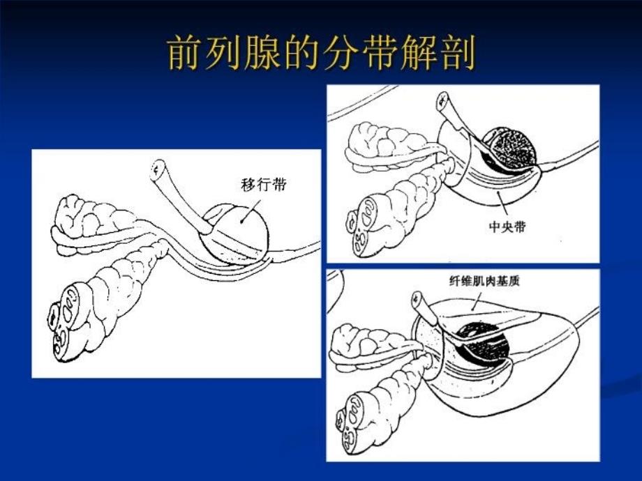 前列腺的MR检查讲课稿_第4页