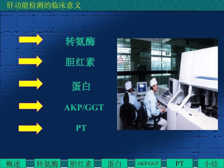 肝功能检测的临床意义.ppt_第5页