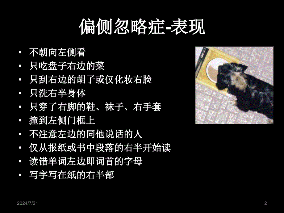 单侧忽略的概述、评定与治疗【专业教学】_第2页