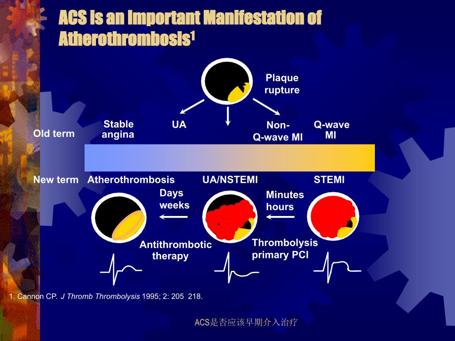 ACS是否应该早期介入治疗课件_第3页