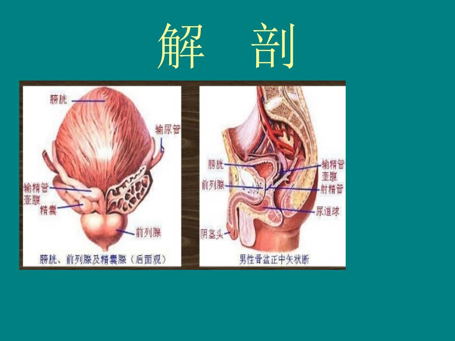 前列腺教学PPT_第3页