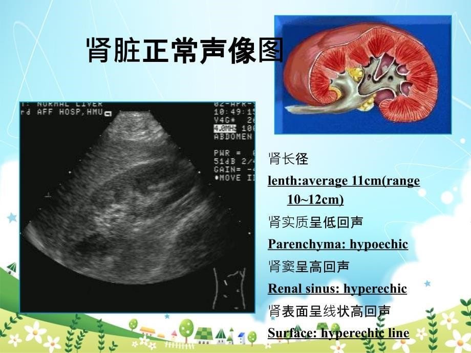 泌尿系超声图_第5页