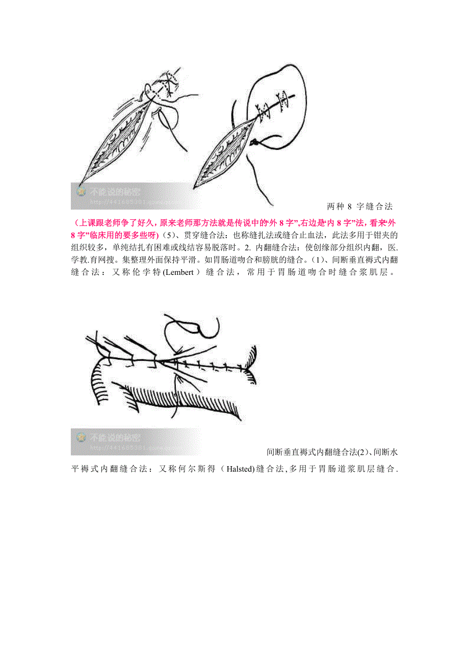 外科缝合的基本方法遇(带图)_第3页