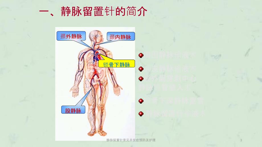 静脉留置针常见并发症预防及护理课件_第3页