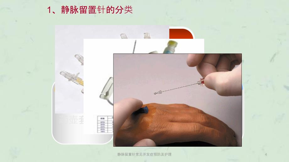 静脉留置针常见并发症预防及护理课件_第4页