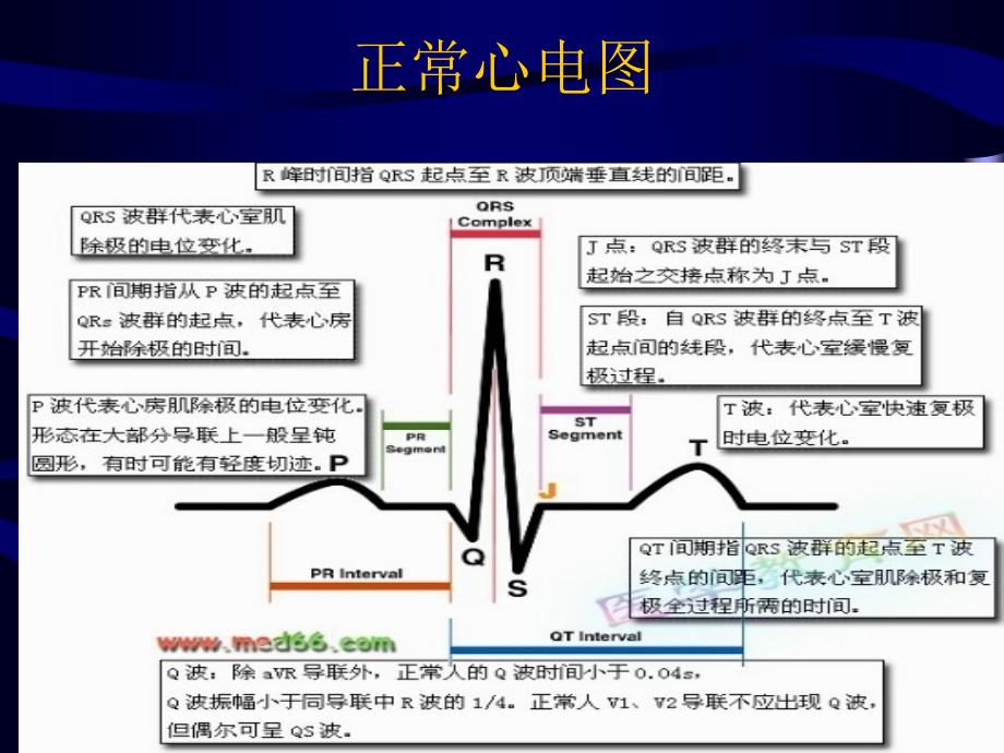 心电监护报警识别课件.ppt_第2页