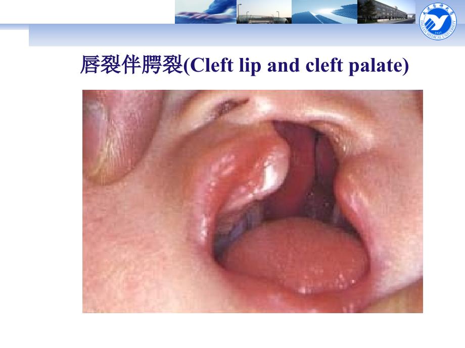 医学教学课件：口腔颌面部发育_第3页