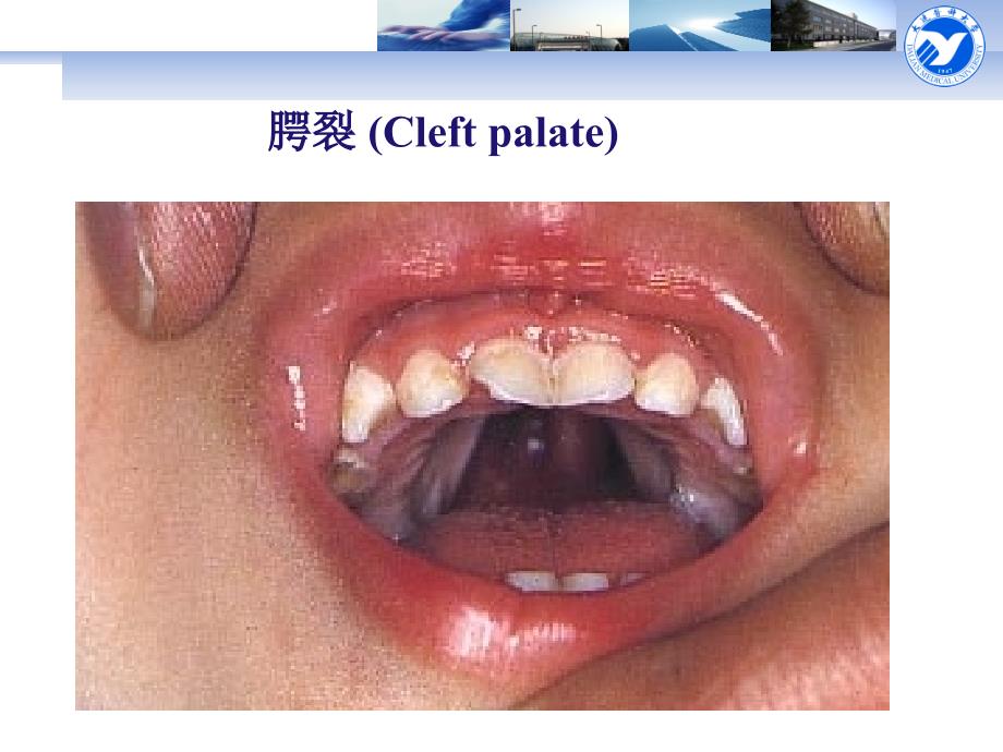 医学教学课件：口腔颌面部发育_第4页