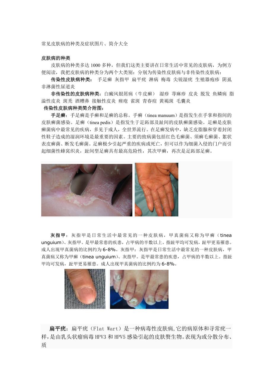 常见皮肤病的种类及症状图片、简介大全 (2).doc_第1页