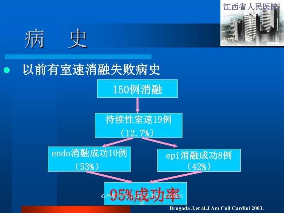 心外膜室性心动过速的射频消融洪浪课件_第5页