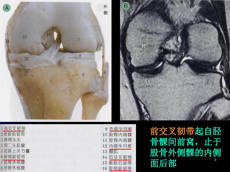 膝关节解剖及MRI诊断35100_第3页