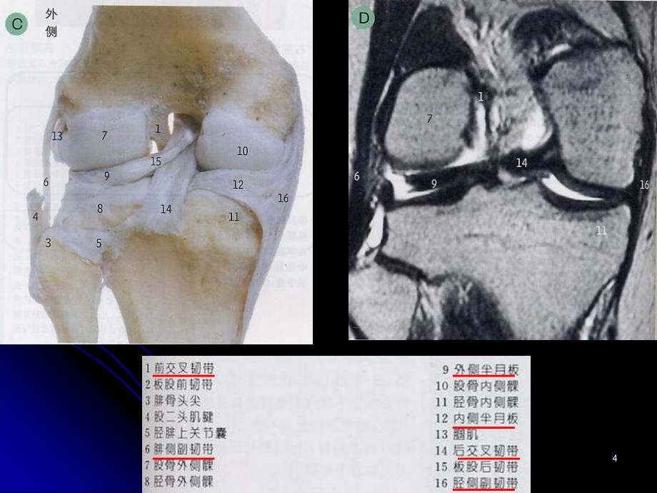膝关节解剖及MRI诊断35100_第4页