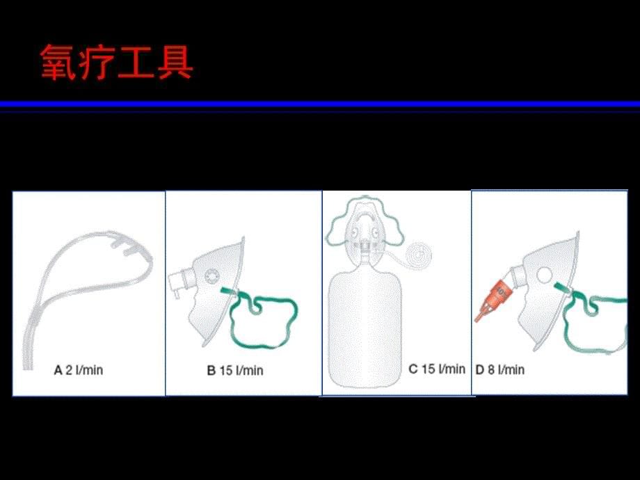 呼吸治疗ppt课件_第5页