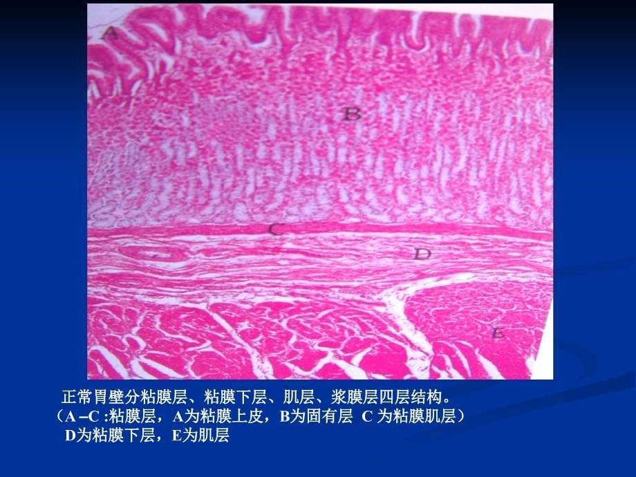 病理实验考：7 消化_第5页