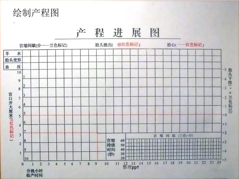 产程中母婴监测技术_第4页