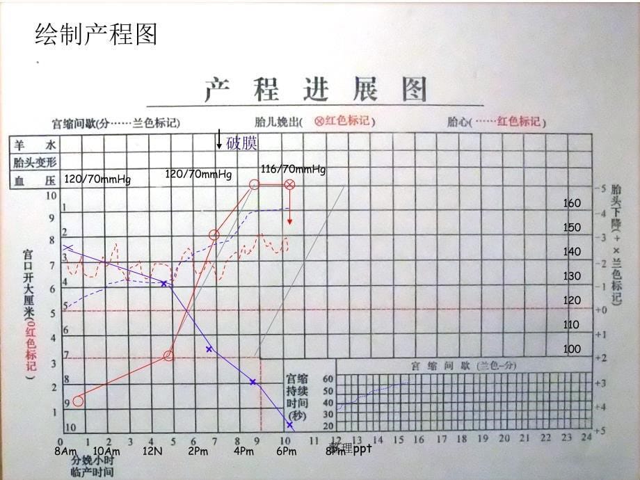 产程中母婴监测技术_第5页