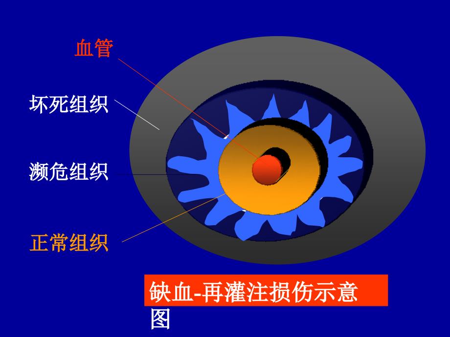 09缺血再灌注损伤精选文档_第4页