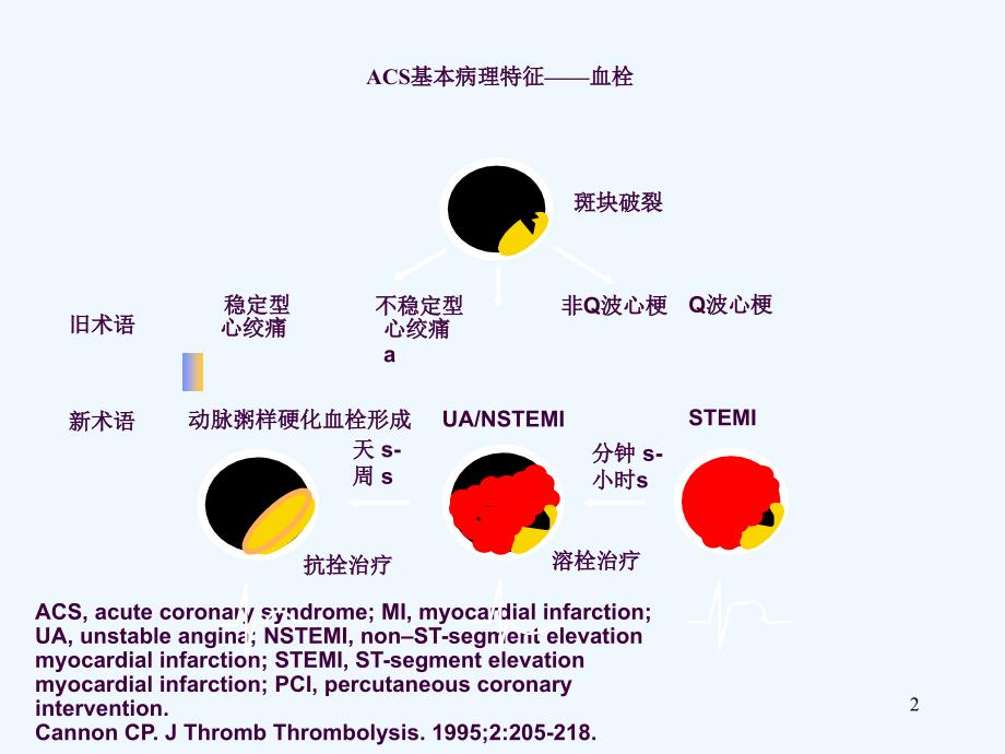 急性冠脉综合征ACS抗凝治疗ppt课件_第2页