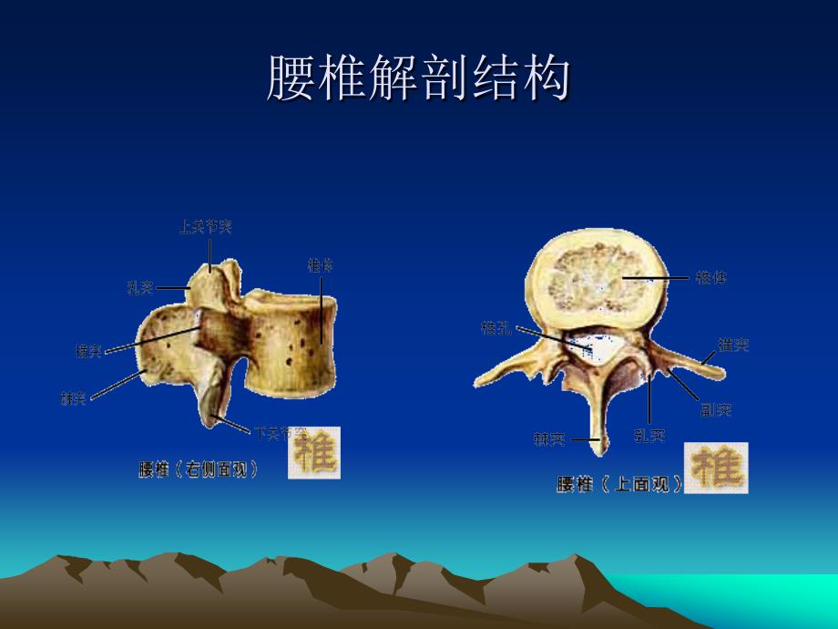 7月腰椎间盘突出症术后护理课件_第2页