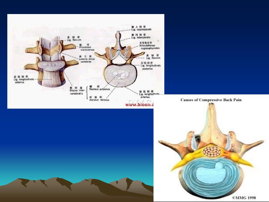 7月腰椎间盘突出症术后护理课件_第4页