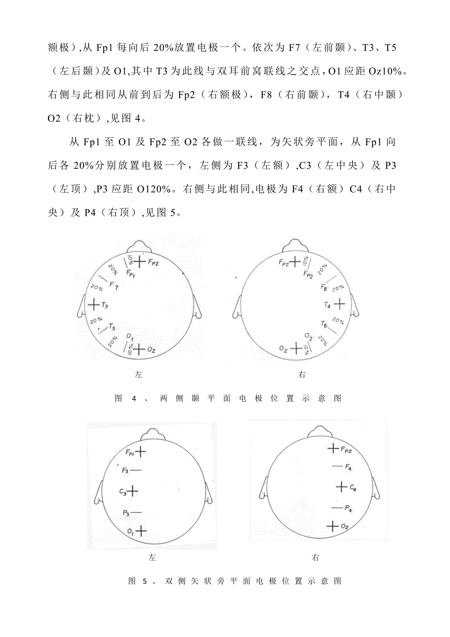 脑电图操作规范_第4页