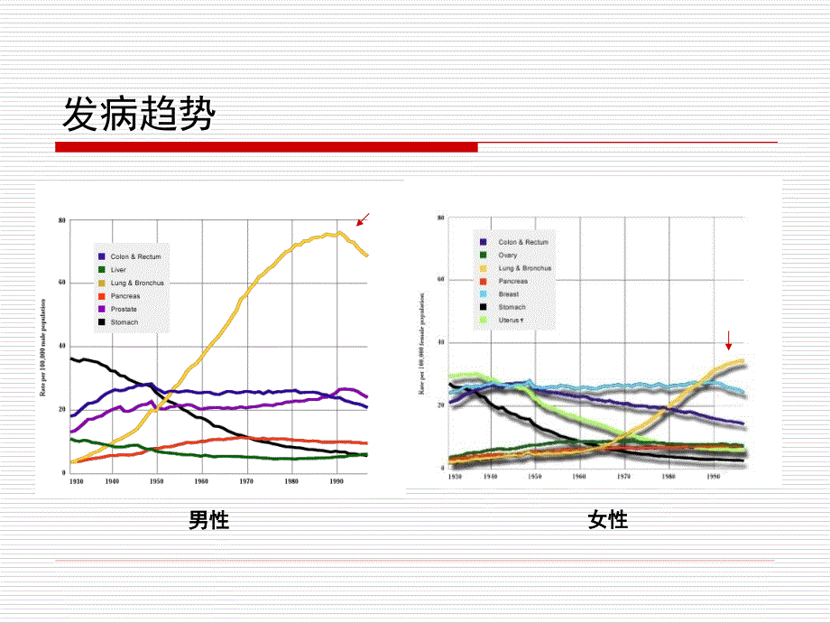 肺癌早期诊断--李凡_第2页