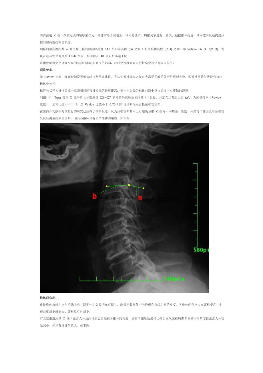 颈椎 X 线诊断.doc_第2页