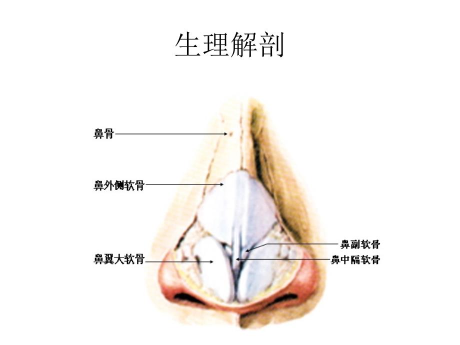 鼻中隔偏曲rosoft PowerPoint 演示文稿_第2页