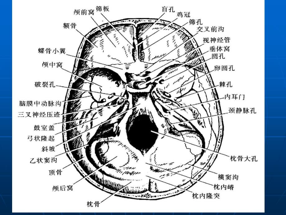 断层解剖学蝶鞍区_第3页