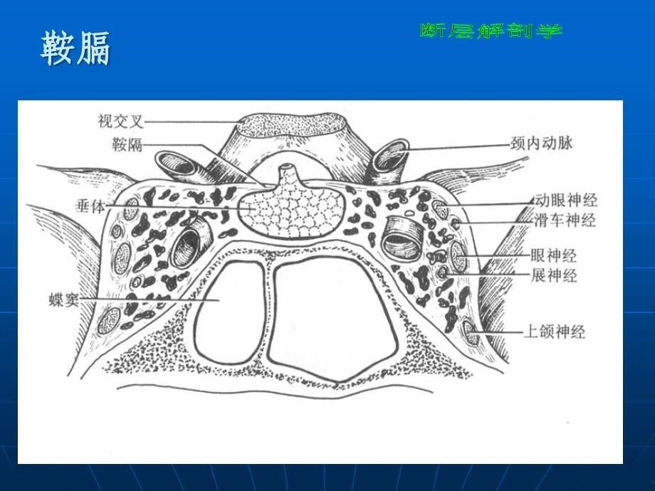 断层解剖学蝶鞍区_第5页