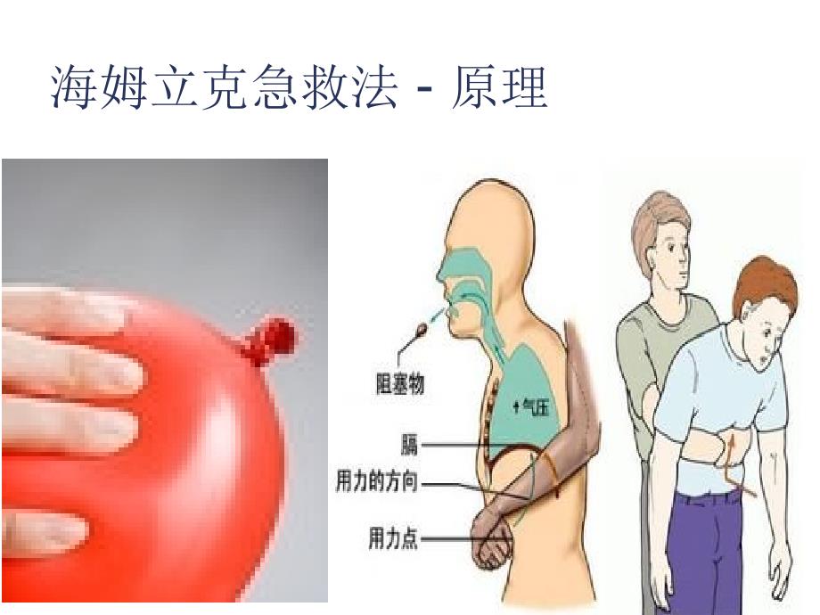 海姆立克急救法ppt.ppt_第4页