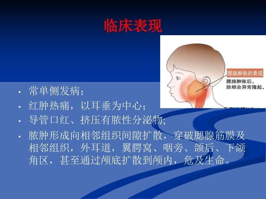 第十二章唾液腺常见疾病讲述_第5页