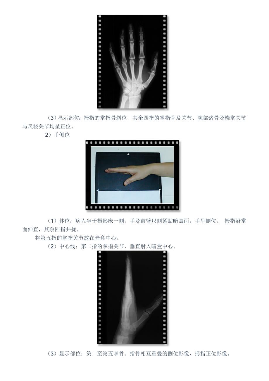 X线检查技术教学_第2页