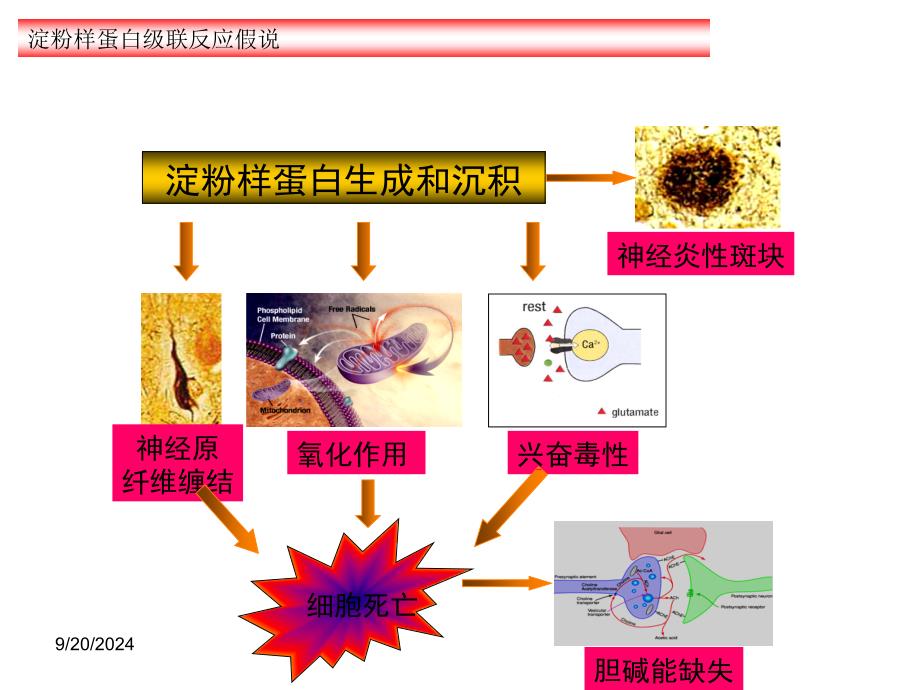 nmdar2b在ad样大鼠海马与ltd的关系_第4页