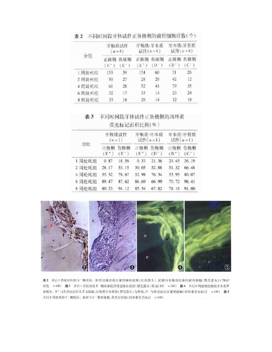 牙体硬组织表面电位影响骨改建的实验研究.doc_第4页