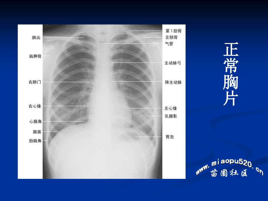 年执业医师技能考试X线课件_第2页