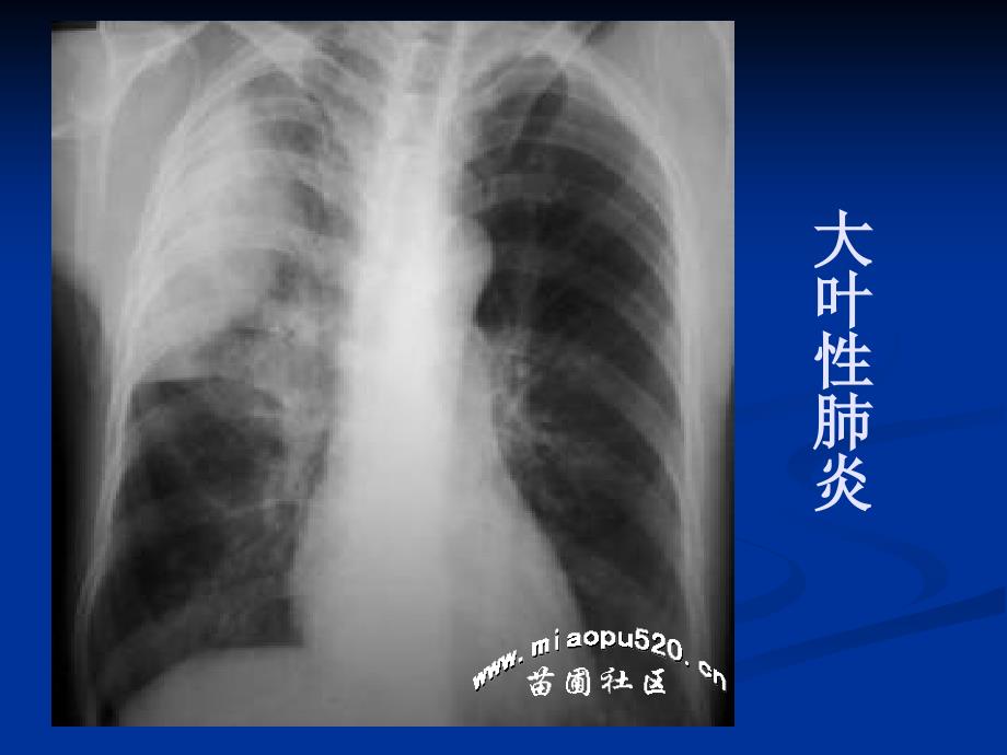 年执业医师技能考试X线课件_第4页