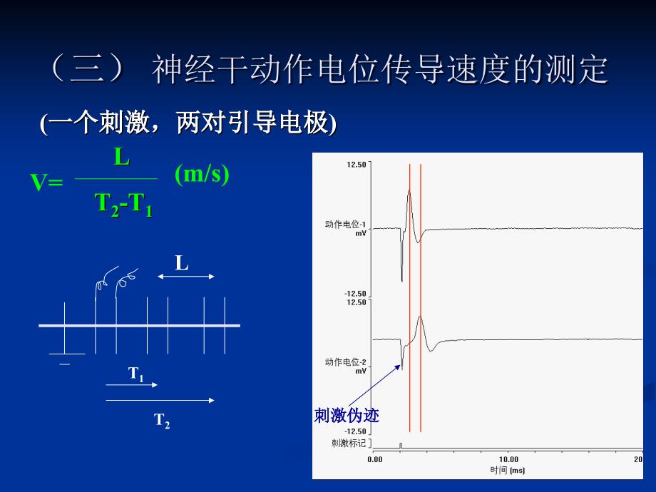 神经干动作电位电生理实验_第4页