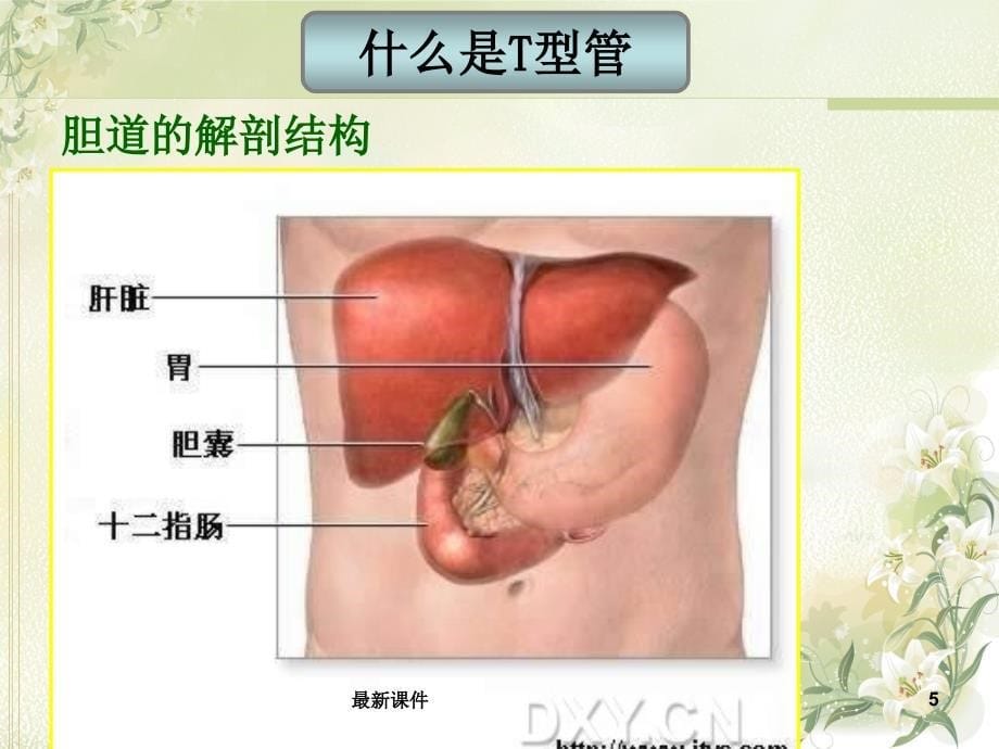 T型管的护理课件_第5页