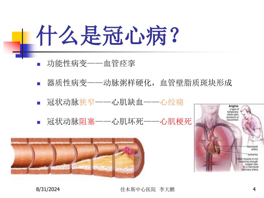 请关爱您的心冠心病患者教育课件_第4页