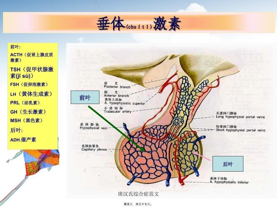 席汉氏综合症范文课件_第5页