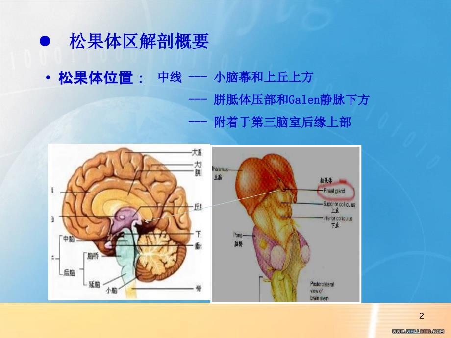 松果体区病变影像学表现共36页_第2页