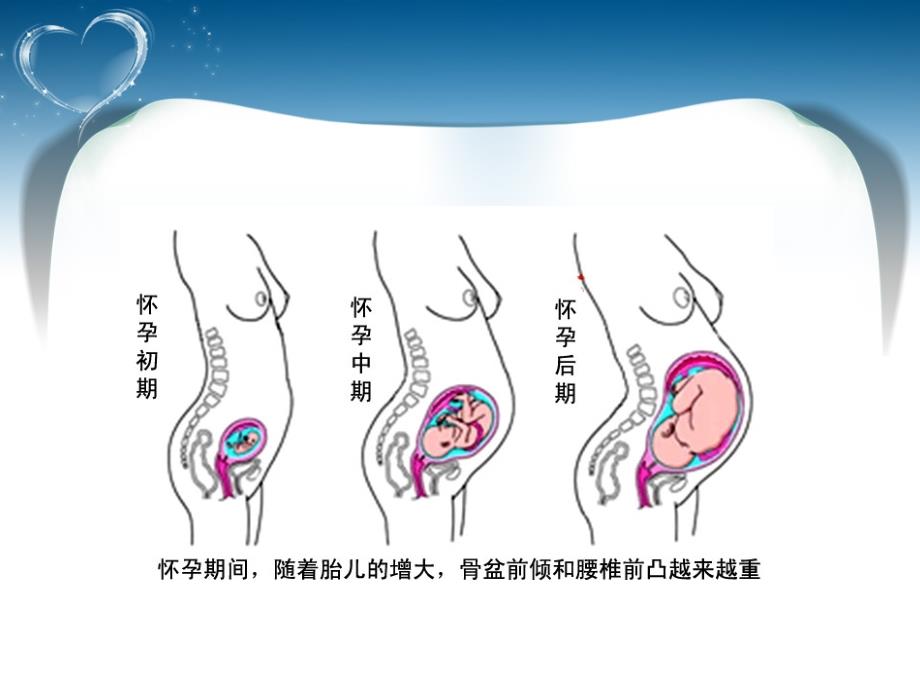 关爱女性盆底健康盆底康复_第3页