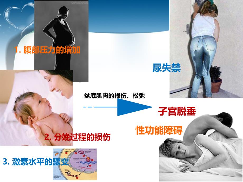 关爱女性盆底健康盆底康复_第4页