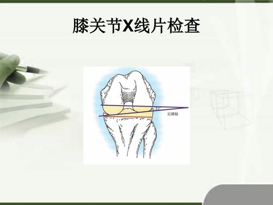 膝关节X线片检查ppt参考课件_第5页