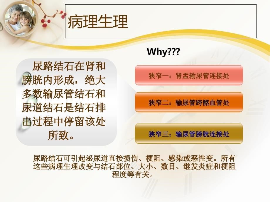 输尿管结石患者的护理查房_第5页