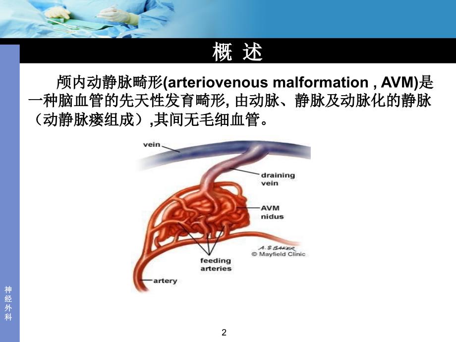 动静脉畸形_第2页