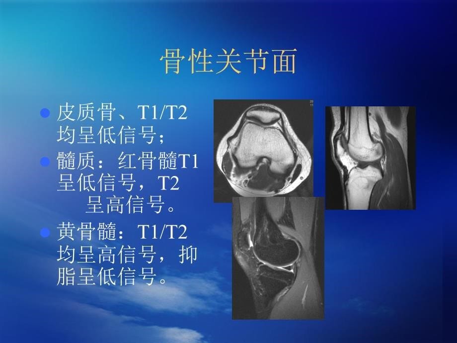 膝关节MRI检查ppt参考课件_第5页