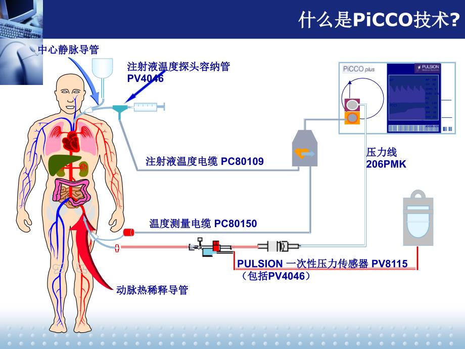 PiCCO监测以及护理_第4页